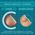 Compeed® Pansements Ampoules Small 6 pansements