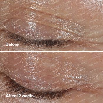 Clinique Smart Clinical Repair Wrinkle Correcting Eye Cream 15 ml oogcrème